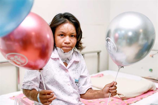 En un conmovedor testimonio de valentía y resiliencia, Roxanita Ponero Chonquiri, una niña de 11 años, ha superado las expectativas médicas después de un trágico accidente de camioneta en la carretera Marginal de Ucayali en julio de 2021.